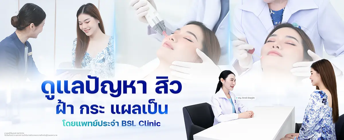 ดูแลปัญหาสิว-ฝ้า-กระ-แผลเป็น