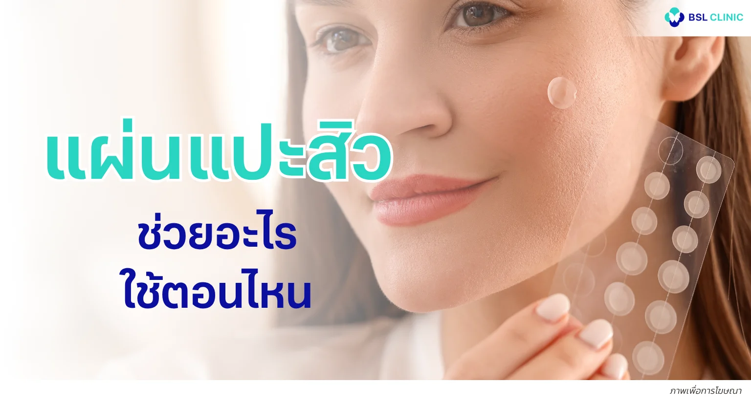 แผ่นแปะสิวช่วยอะไร