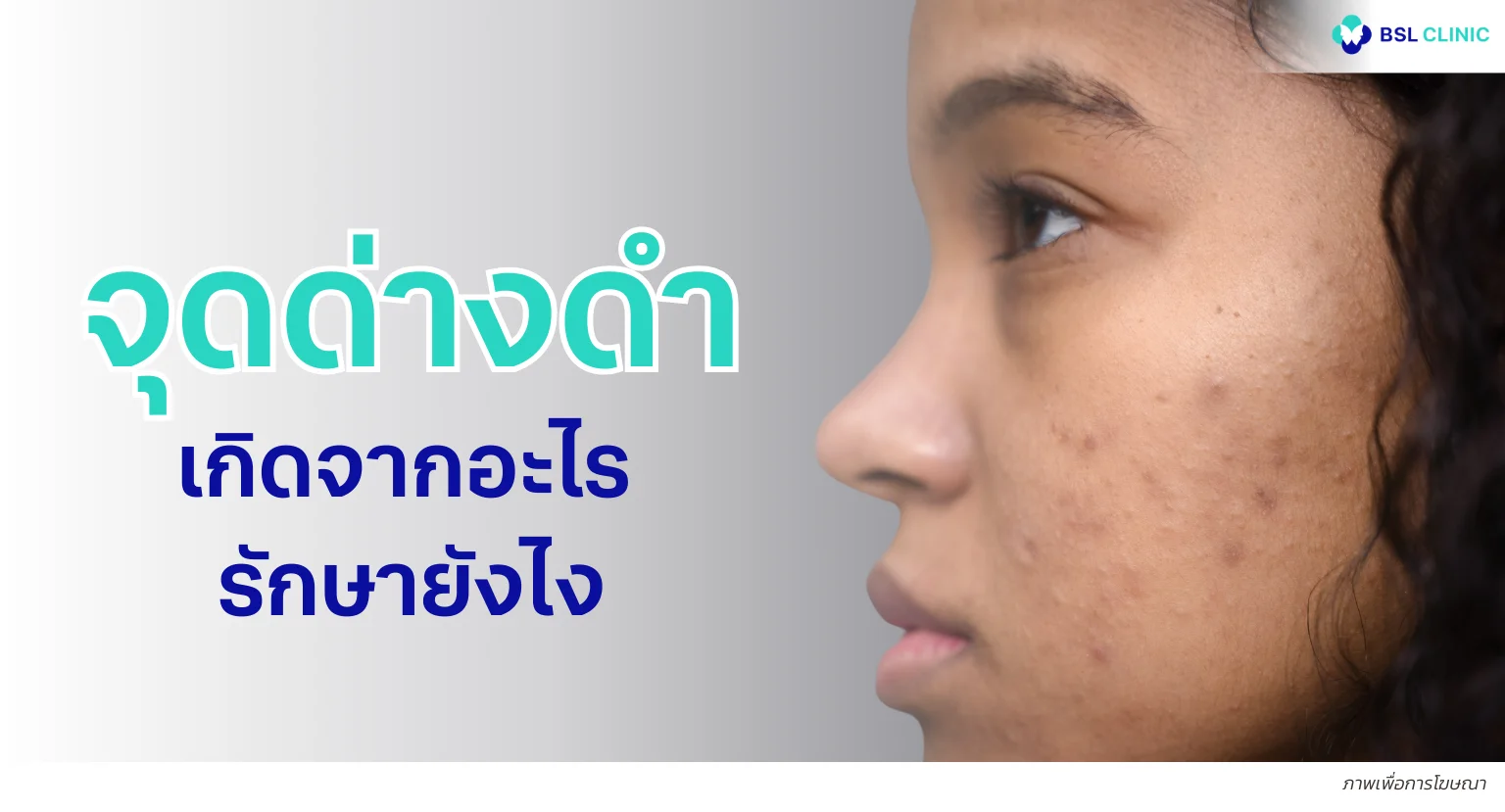 จุดด่างดำ