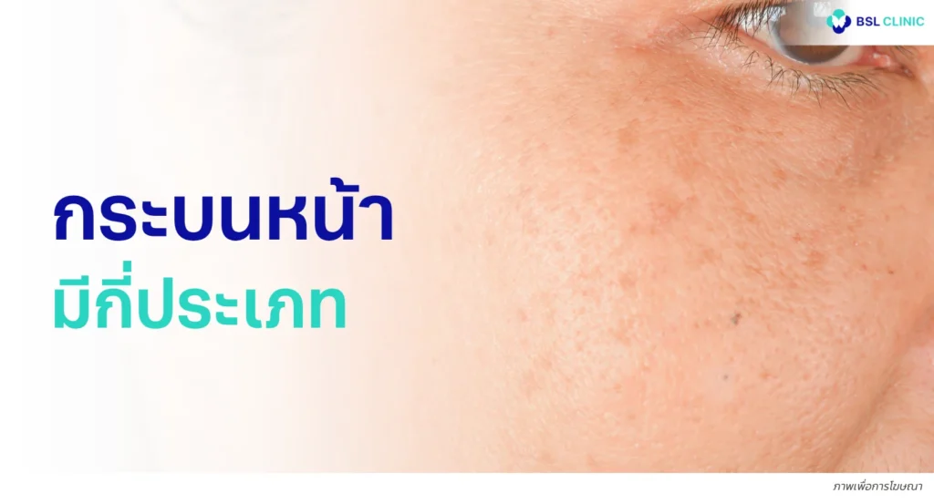 กระบนหน้า