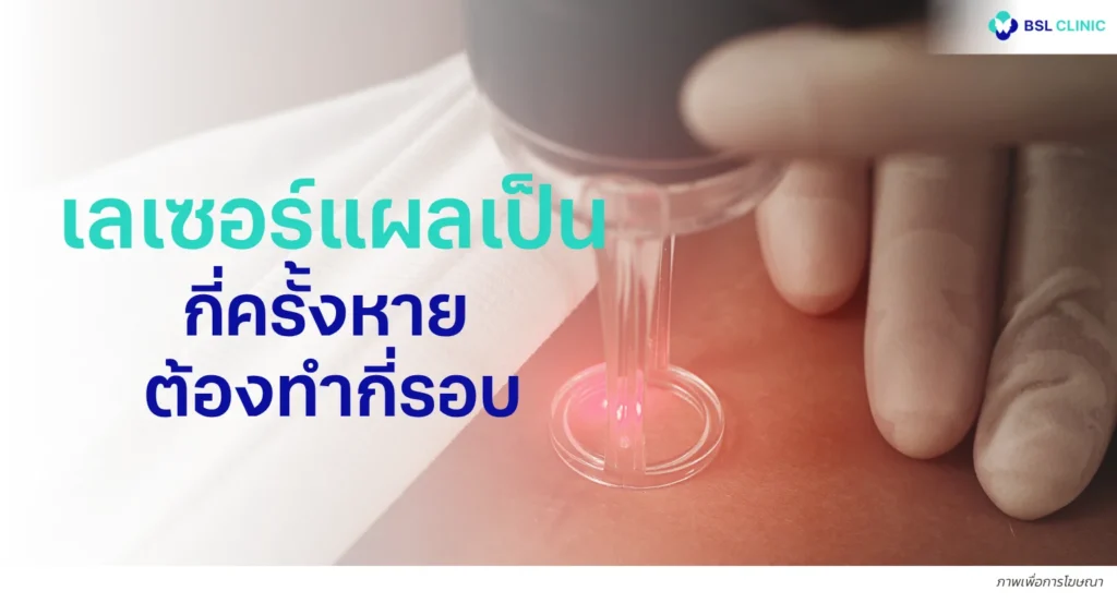 เลเซอร์แผลเป็นกี่ครั้งหาย